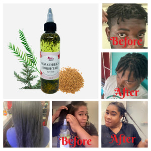 Fenugreek & Horsetail Hair Growth Oil